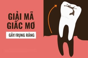 Nằm mơ thấy rụng răng báo hiệu điều gì? Đánh con gì dễ trúng